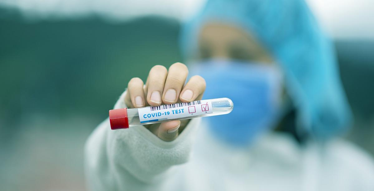 Medico con test anti covid - Foto di fernando zhiminaicela da Pixabay