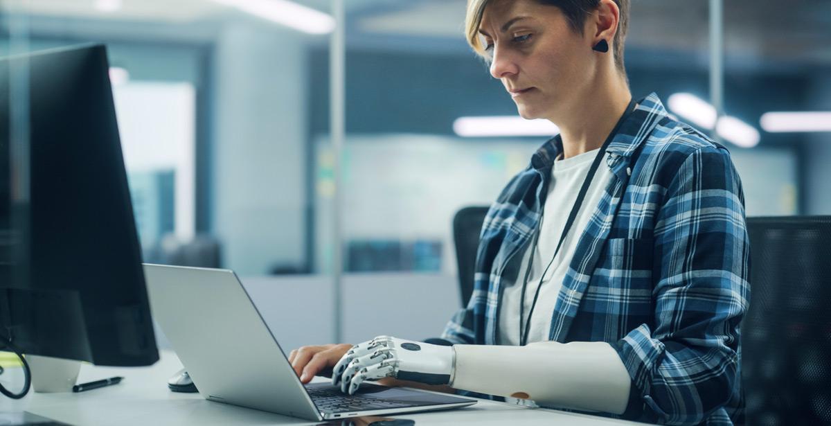 Ragazza con braccio meccanico lavora al pc - Foto di Gorodenkoff da Adobe Stock